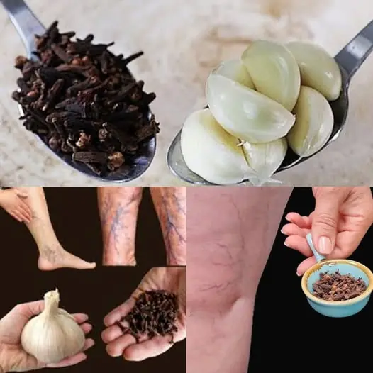 Natural Remedy for Leg Pain and Arthritis Relief