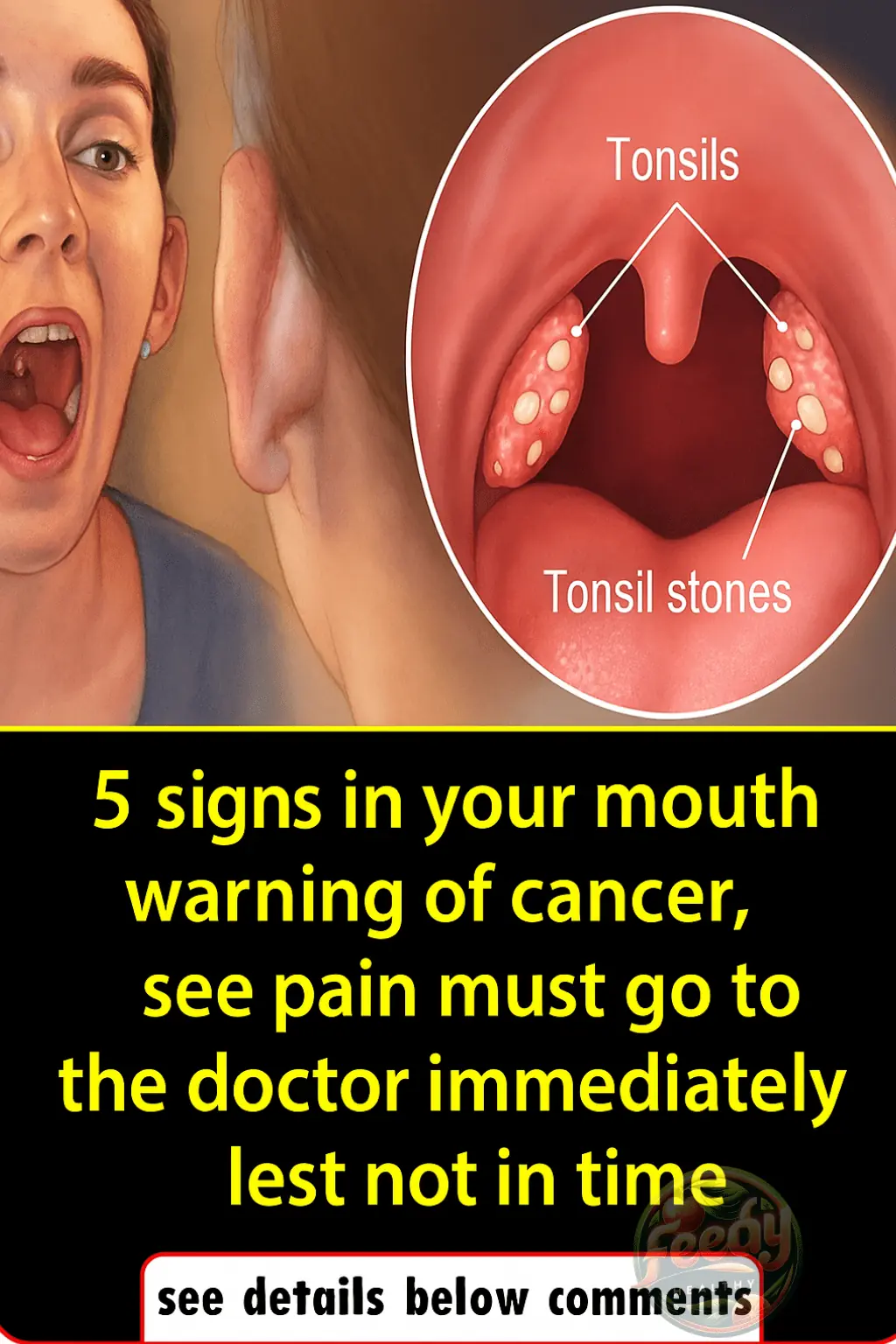 5 Mouth Symptoms That Could Signal Cancer – Don’t Ignore the Pain