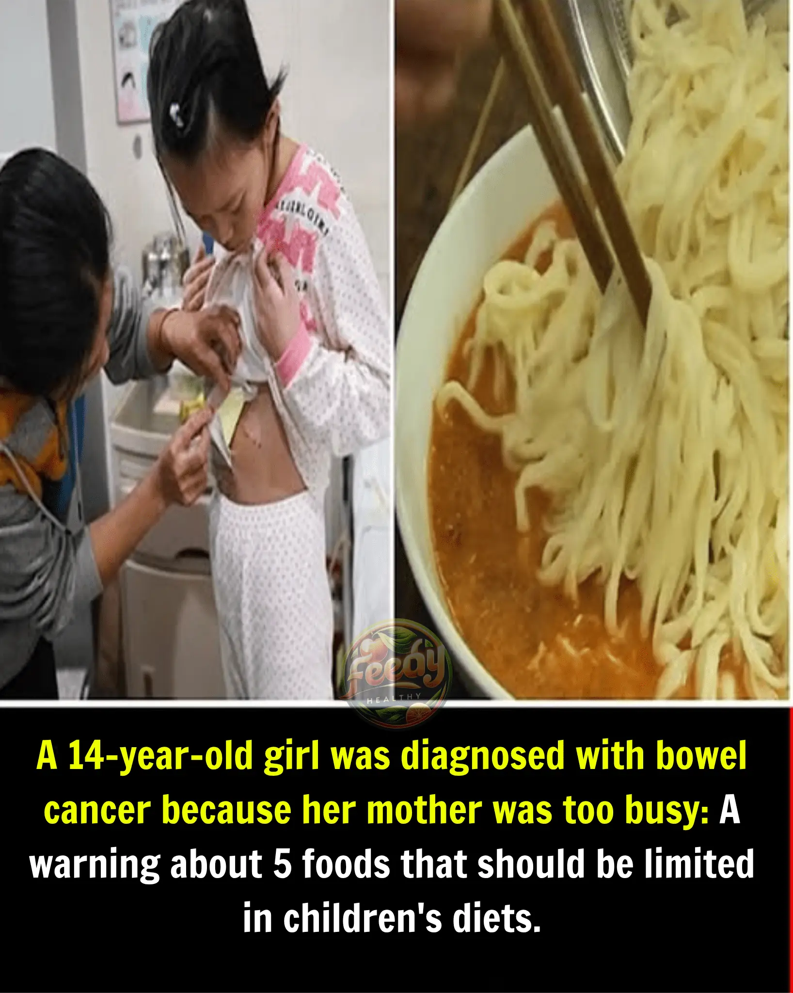 A 14-Year-Old Girl Diagnosed with Bowel Cancer Due to Her Mother's Busy Schedule: A Wake-Up Call About 5 Foods Children Should Never Eat for Breakfast