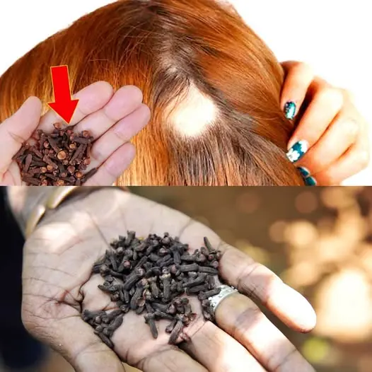 Transform Your Hair with the Power of Cloves