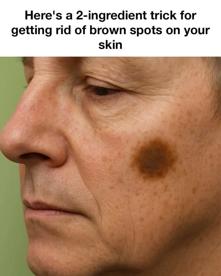 Here's a 2-ingredient hack for getting rid of brown spots on your skin
