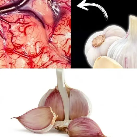 Take Garlic, But Don’t Make the Same Mistake Many People Do