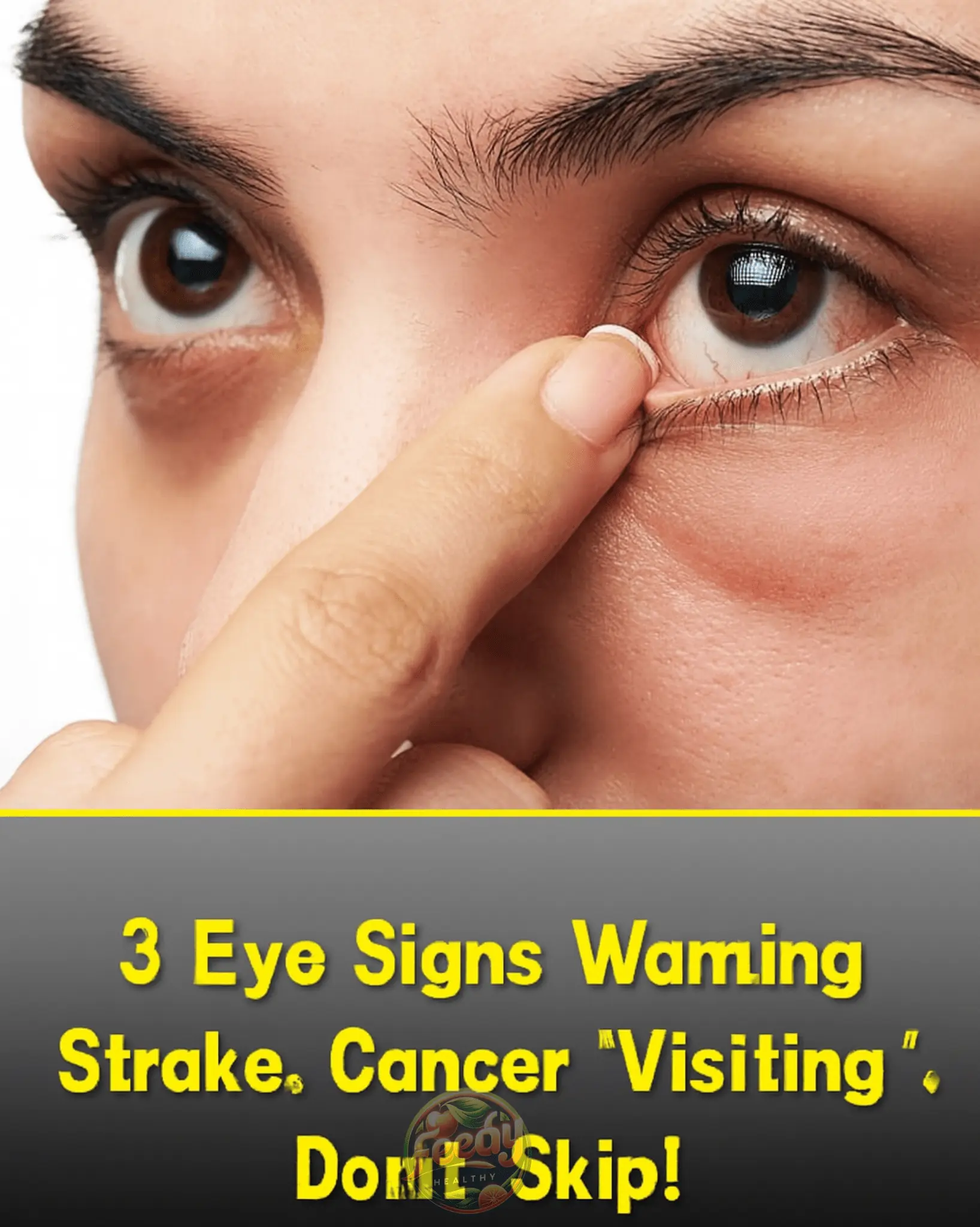 3 Eye Symptoms That Signal Hidden Health Issues: High Cholesterol, Stroke, and Cancer