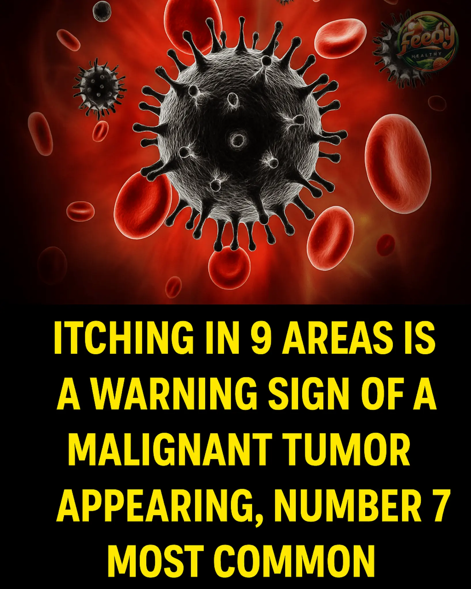 Itching in 9 Areas: A Warning Sign of Malignant Tumors, Number 7 Is the Most Common