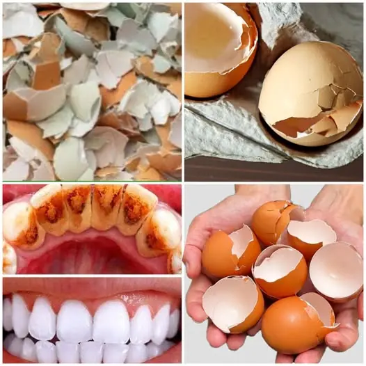 Say Goodbye to Yellow Teeth: The Natural Eggshell Trick for a Radiant Smile!