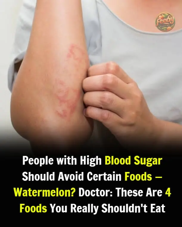 People with High Blood Sugar Should Avoid Certain Foods—Watermelon? Doctor: These Are 4 Foods You Really Shouldn't Eat