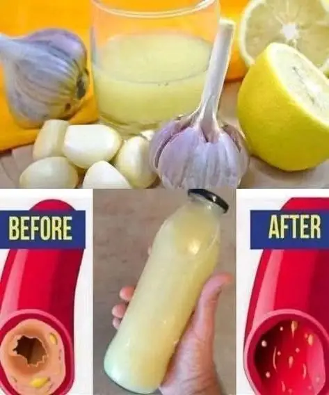 Refresh Your Body with Lemon & Garlic Detox Remedy