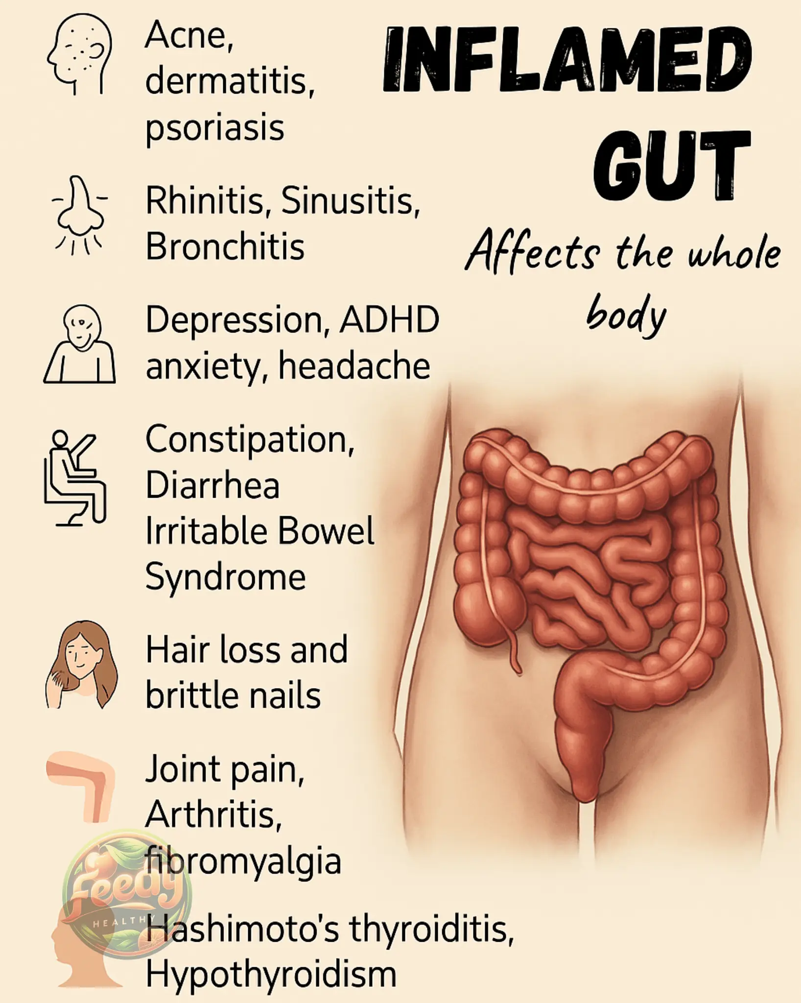 NATURAL REMEDIES FOR INFLAMED GUT