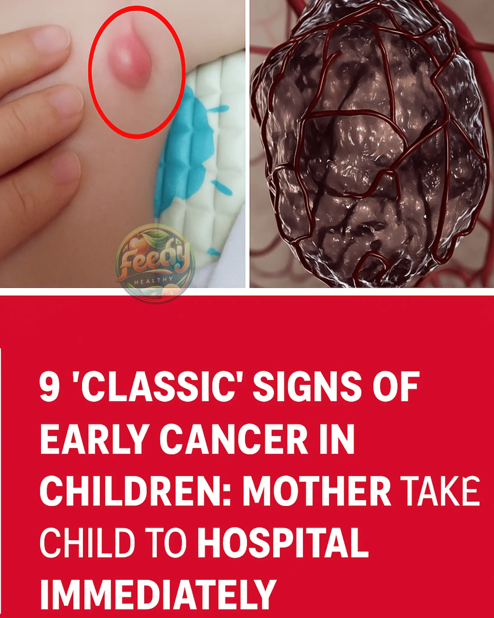 9 βClassicβ Symptoms Signaling Early-Stage Cancer in Children: Parents Should Take Their Child to the Hospital Immediately
