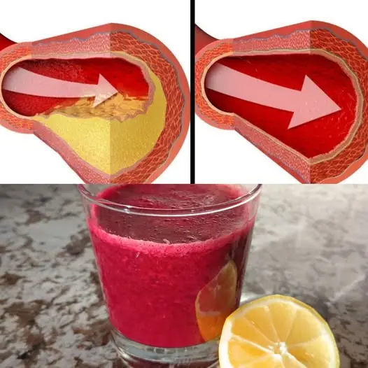 Rejuvenate Your Heart with This Miracle Juice!