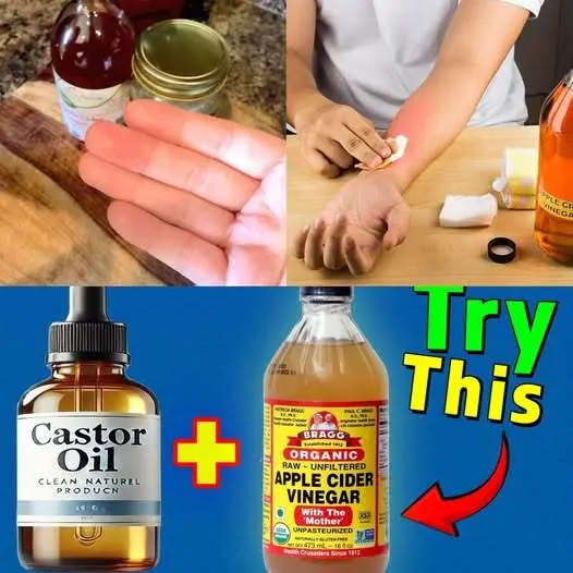 The Amazing Fusion of Castor Oil and Apple Cider Vinegar