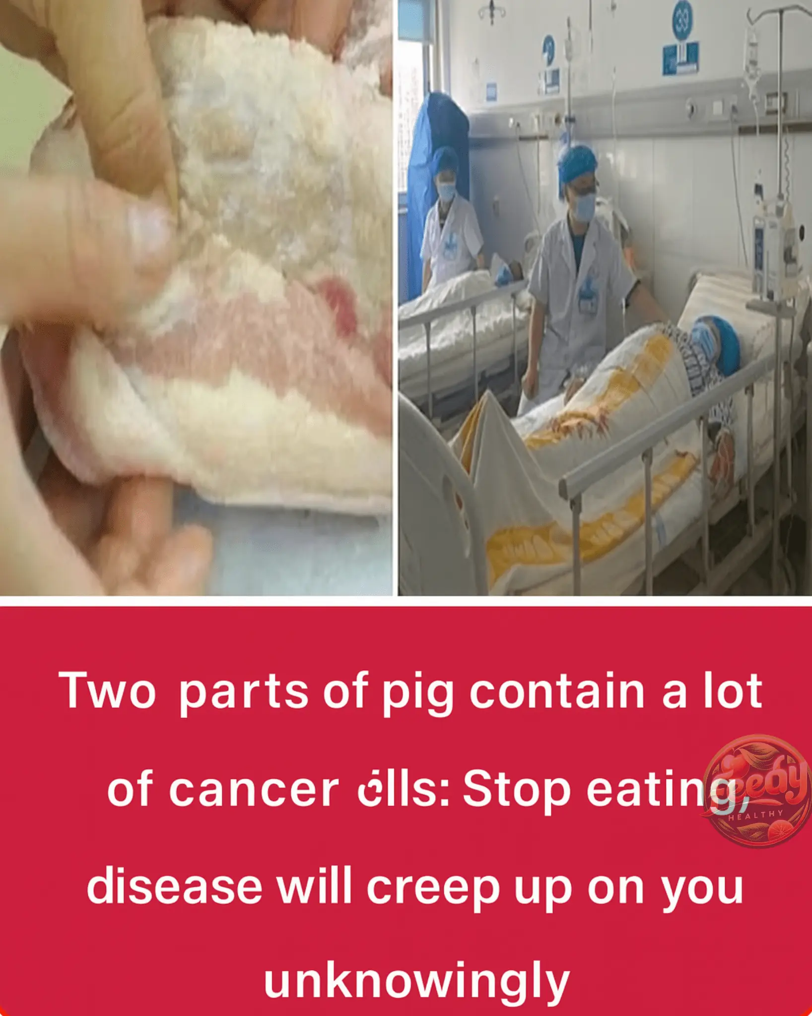 Two Pig Parts That May Contain Cancer Cells: Avoid Them to Protect Your Health