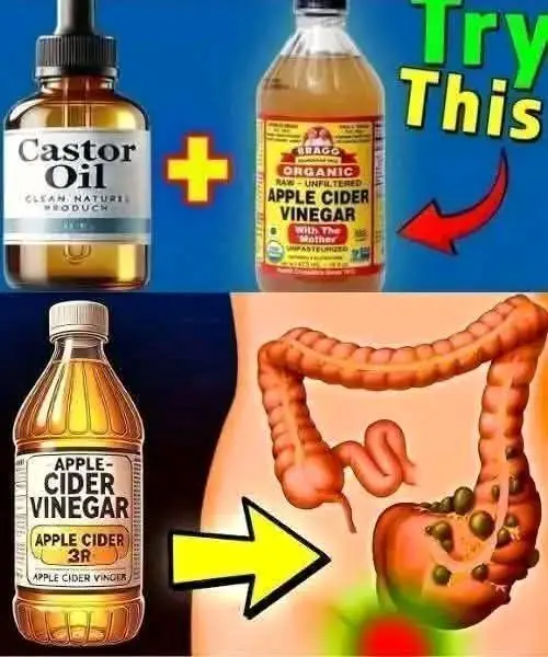 Discover the Magic of Castor Oil and Apple Cider Vinegar