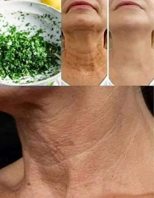 Homemade Parsley Mask for Aging Skin
