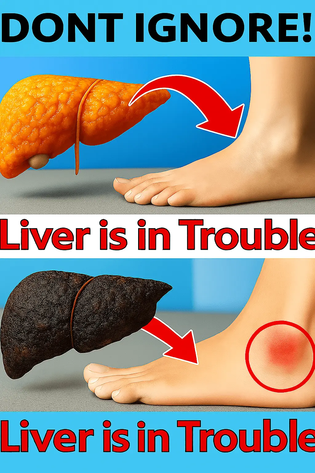 How Your Feet Are Warning You About Liver Problems: What You Need to Know