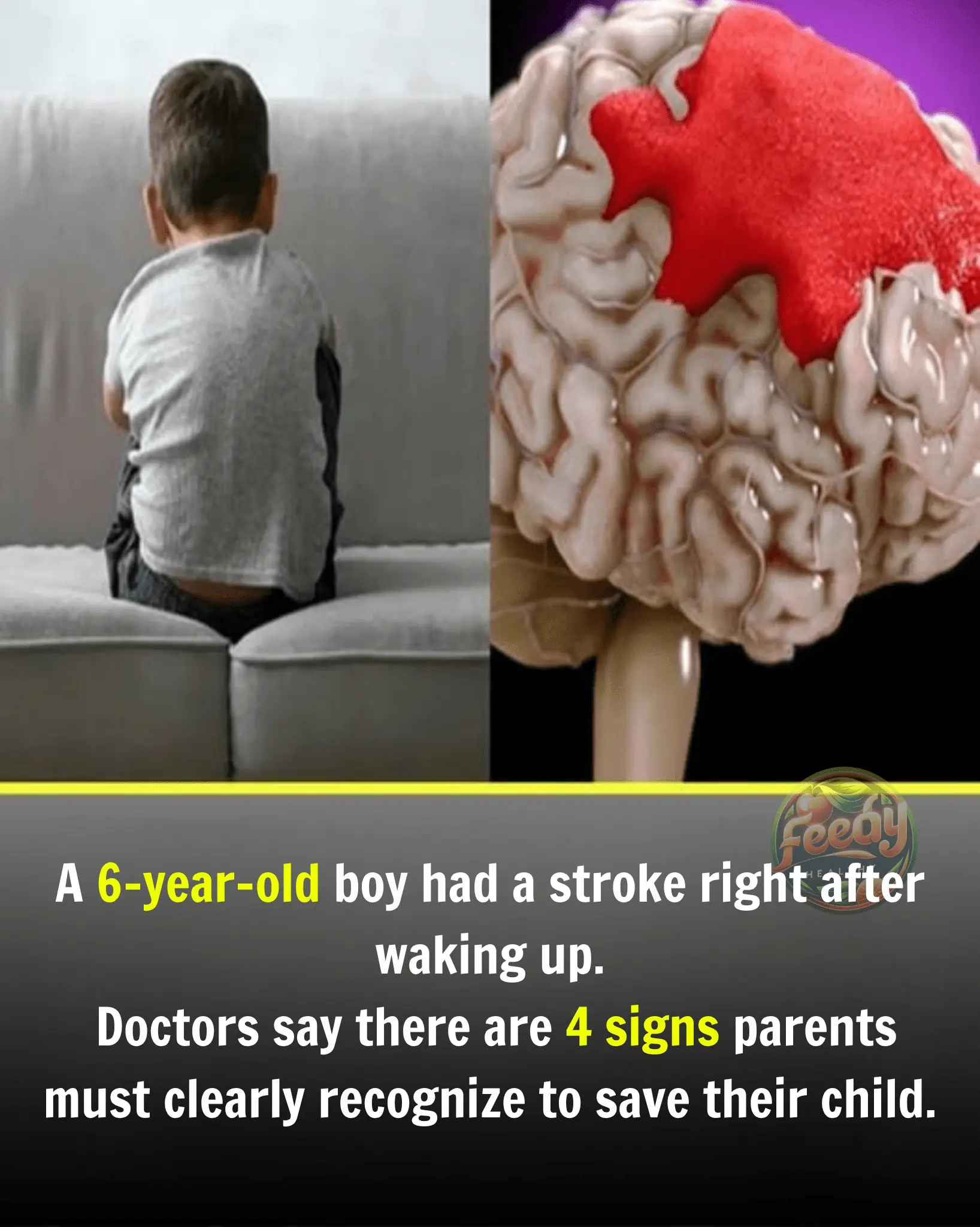 6-Year-Old Boy Suffers Stroke Right After Waking Up – Doctors Emphasize 4 Warning Signs Parents Must Recognize to Save Their Child