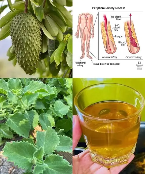 Benefits of Soursop and Oregano Tea: A Natural Remedy for Your Health