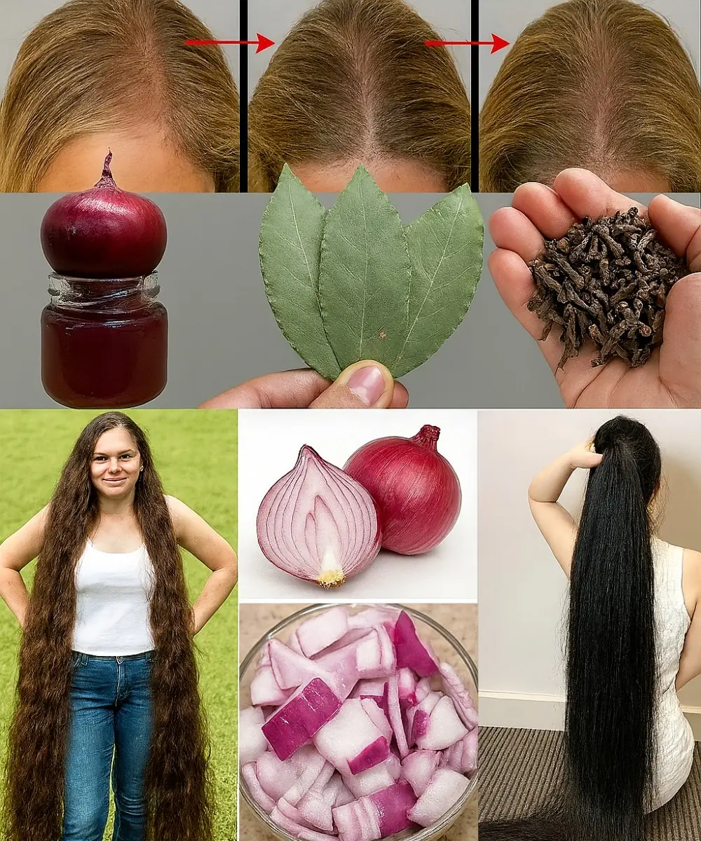Discover the Magic of Cloves and Onion Peels: Your Hair’s New Best Friends