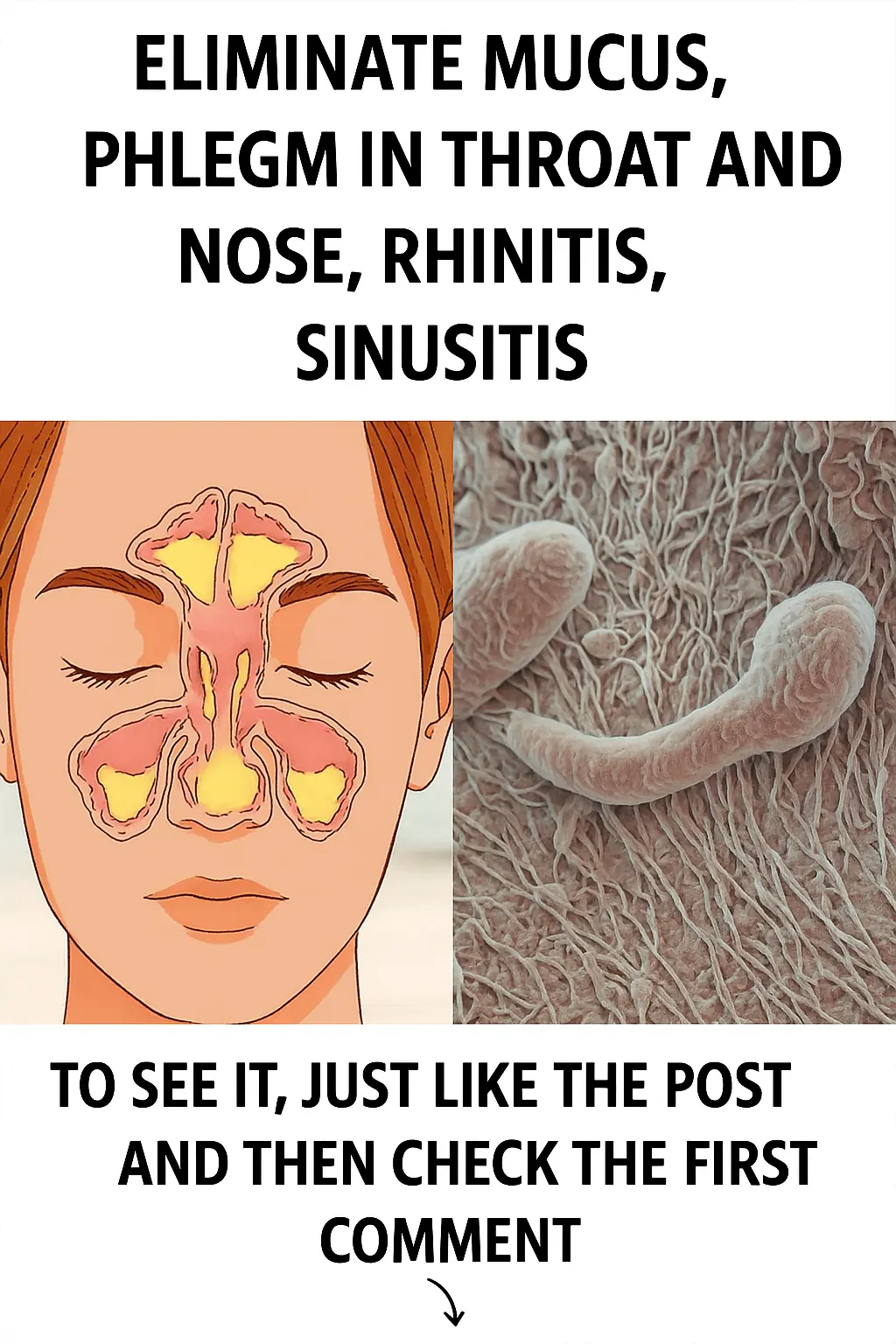 Effective Home Remedies to Eliminate Mucus and Phlegm