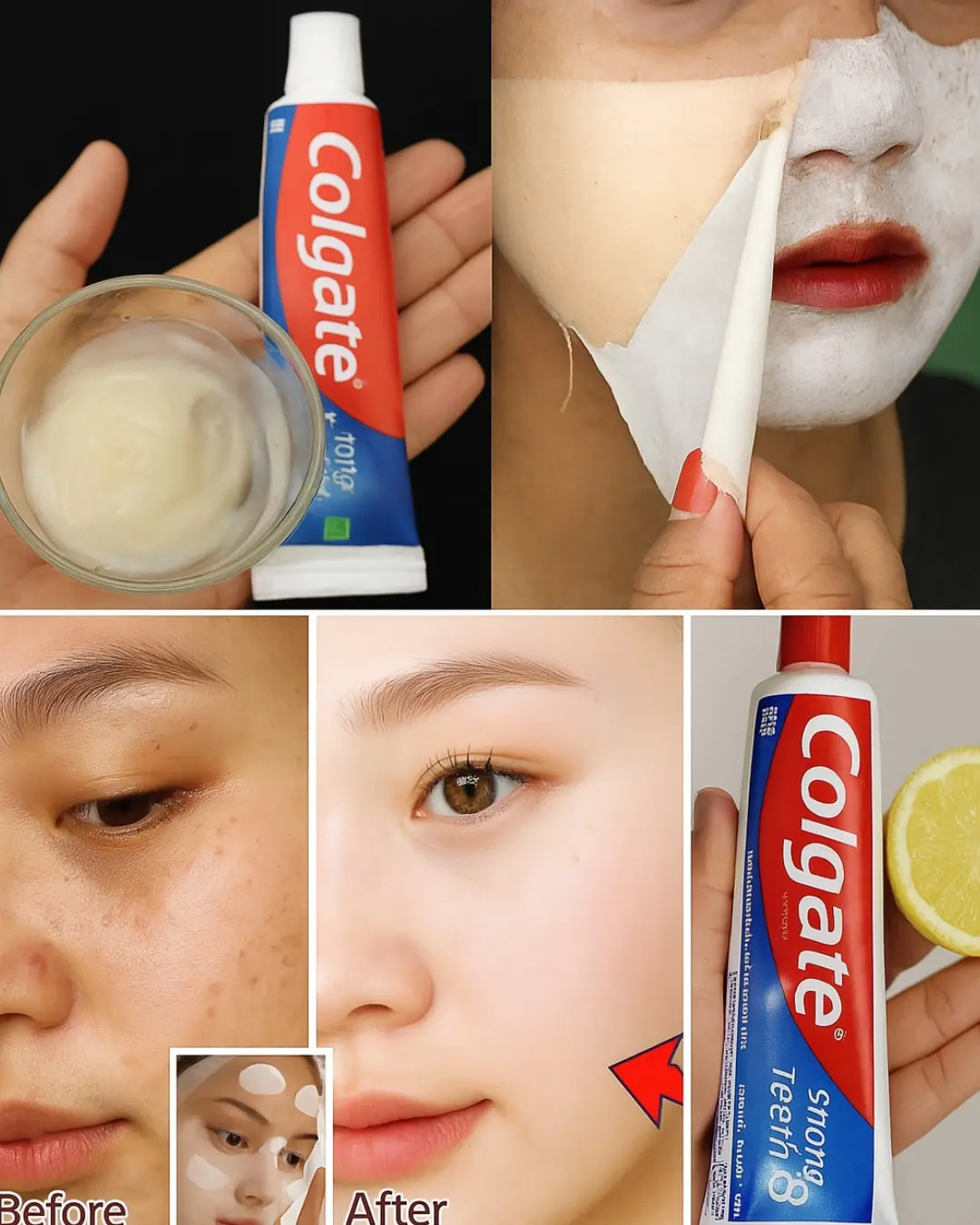 Colgate and Lemon for Face Whitening: Miracle Hack or Risky Trend?