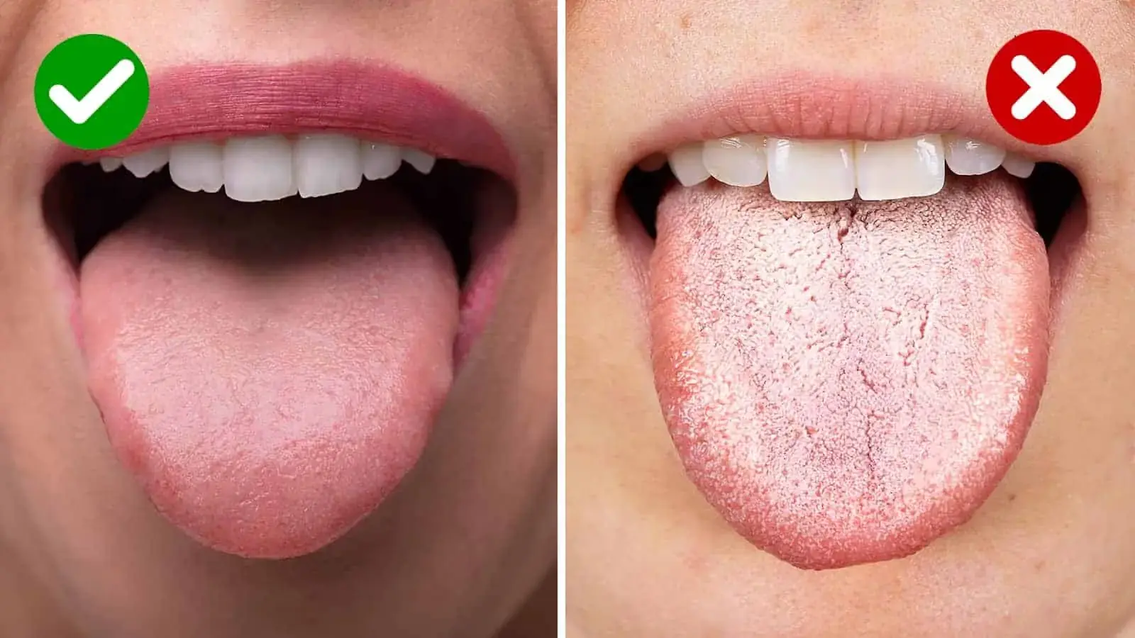 If you’re experiencing these four tongue symptoms, they could indicate underlying health conditions.