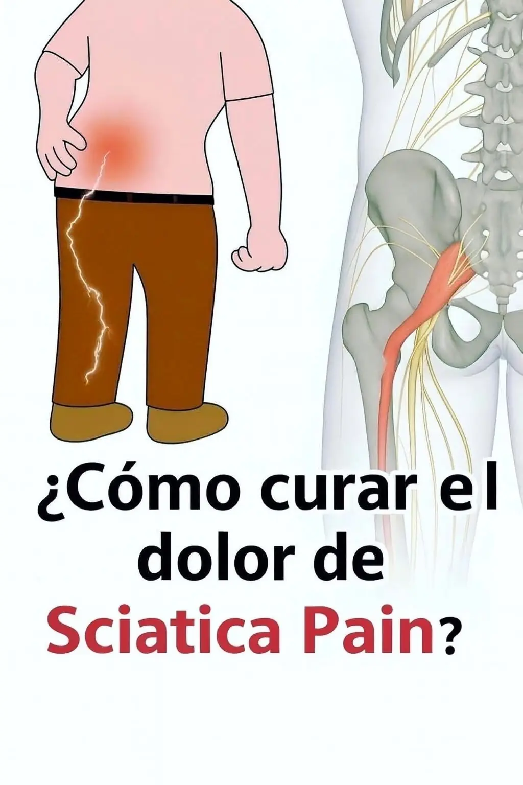 Say Goodbye to Lower Back and Sciatic Pain: Effective and Natural Techniques