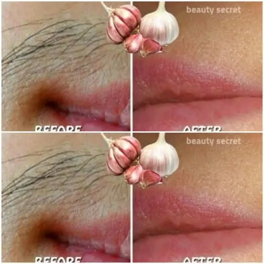 Stop Shaving! Here’s a Natural Way to Reduce Unwanted Hair Using Garlic