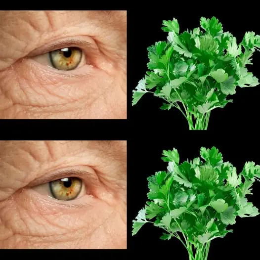 Unbelievable! I 100% Restored My Vision with This Powerful Parsley Drink