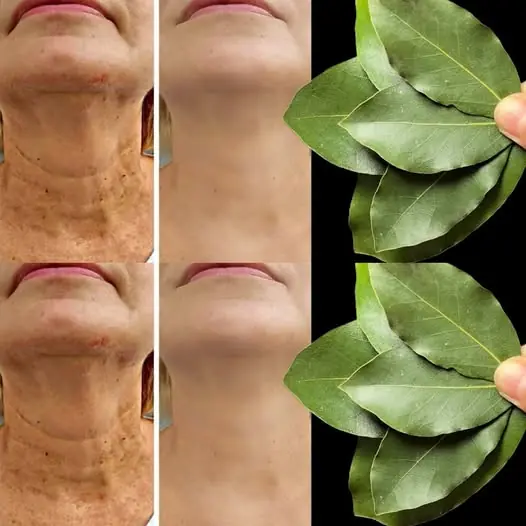Bay Leaf Is 100,000 Times Stronger Than Botox? | Natural Wrinkle Eraser Even at Age 70! ✨🧖‍♀️