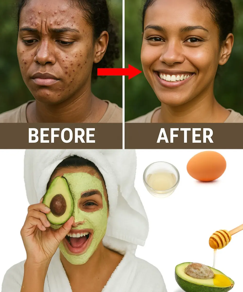 Egg White Magic: Banish Blackheads Naturally with One Simple Ingredient