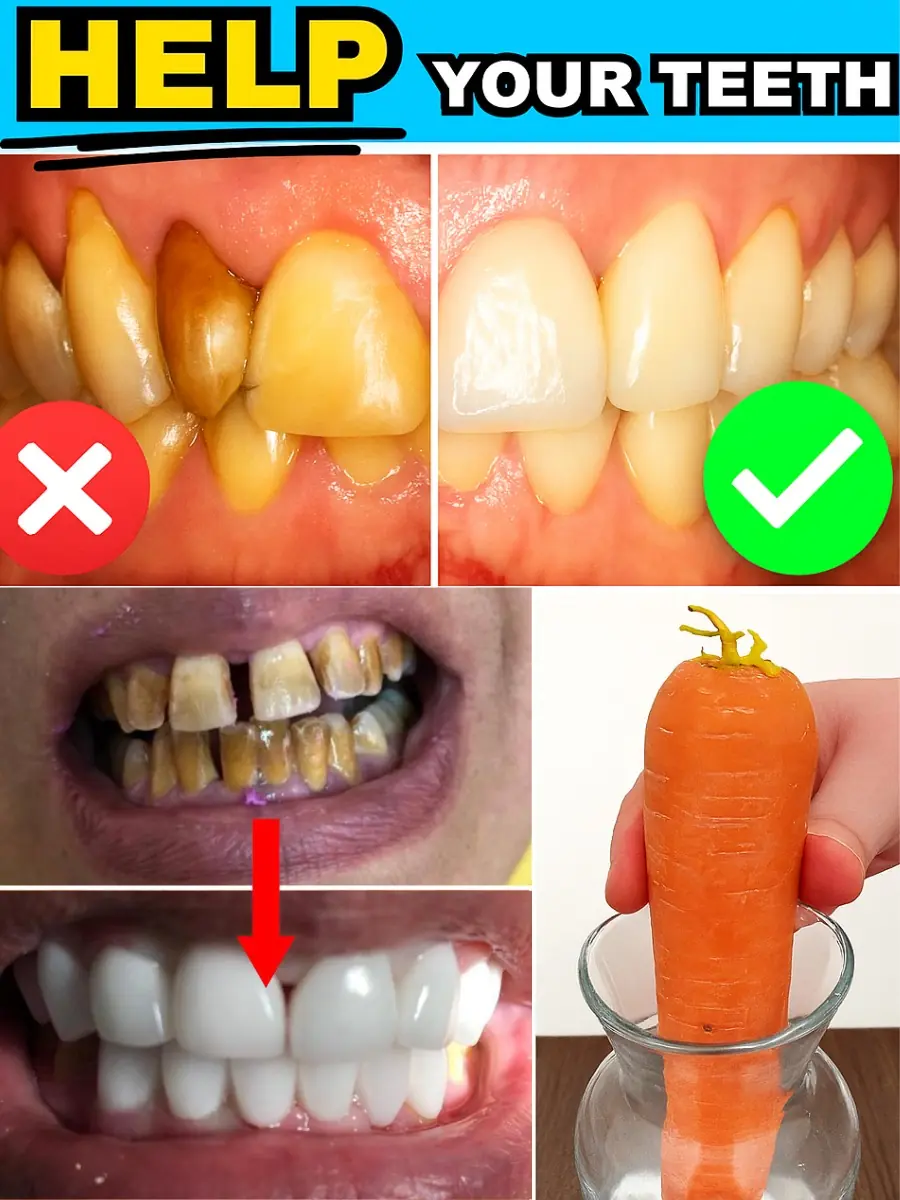 Shocking Carrot Secret: Whiten Your Teeth in Just 2 Minutes for a Dazzling Smile!
