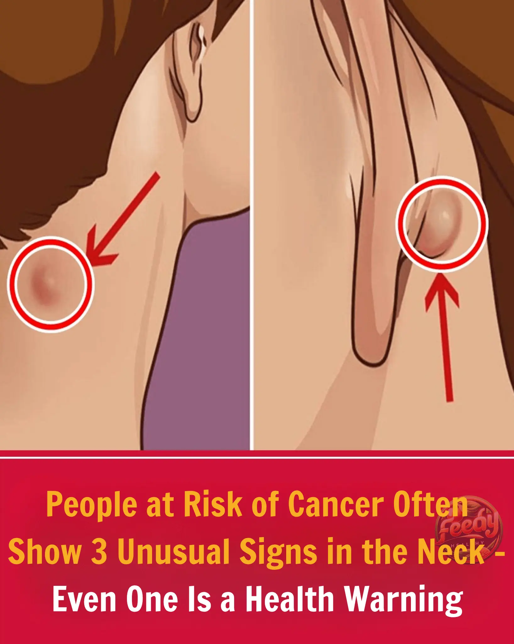 People at Risk of Cancer Often Show 3 Unusual Signs in the Neck – Even One Is a Health Warning