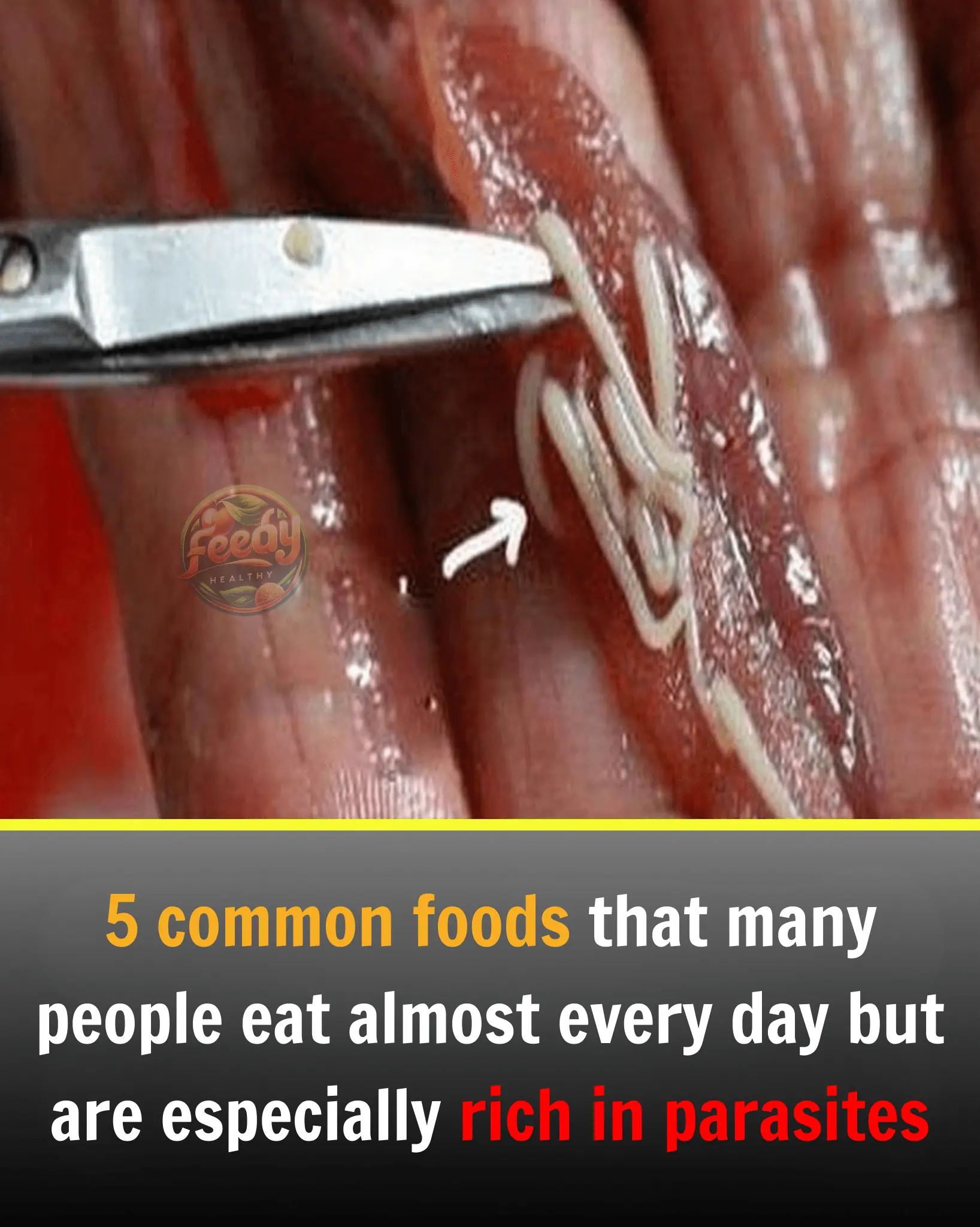 5 common foods that many people eat almost every day but are especially rich in parasites
