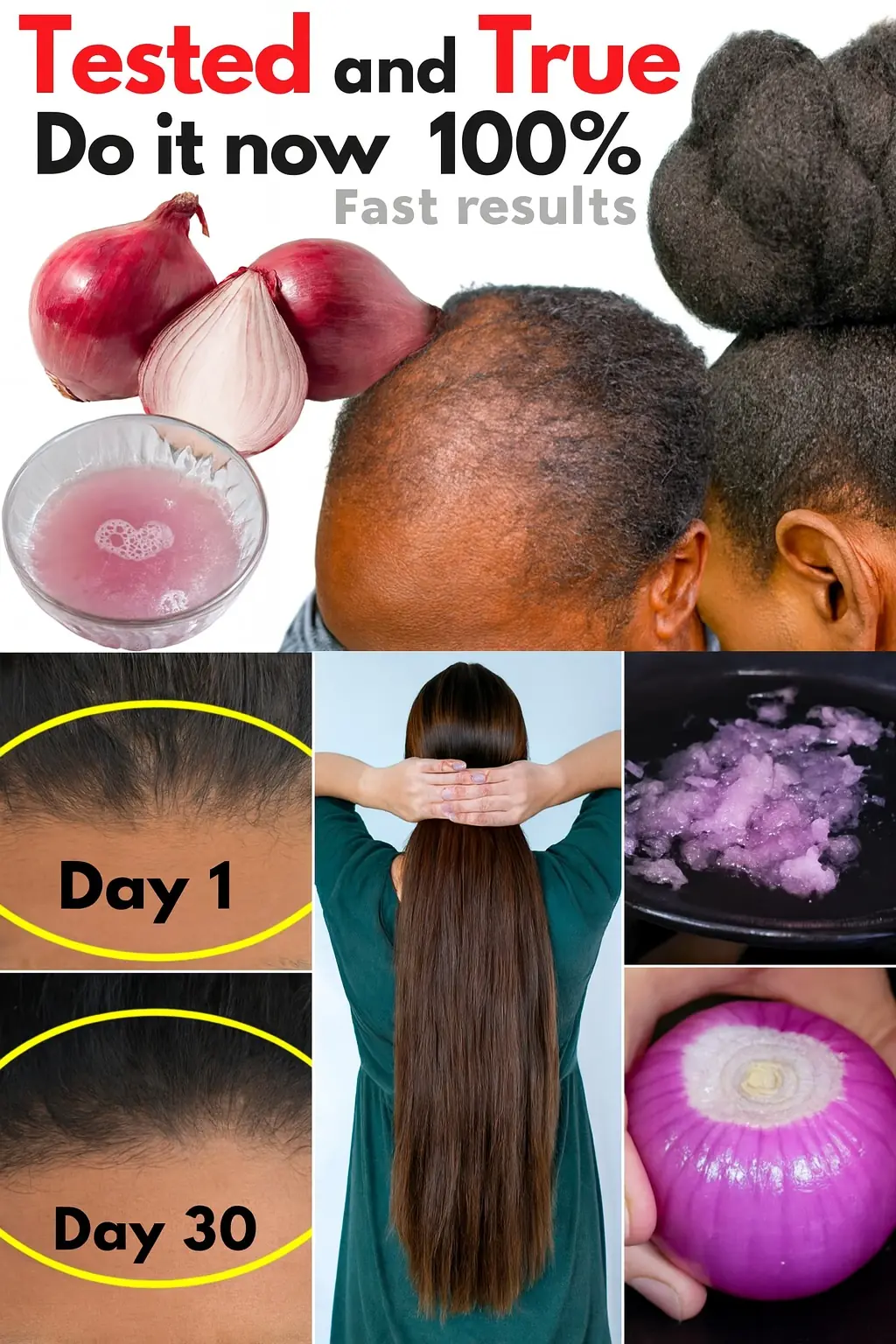Onion Peels: The Secret to Naturally Dyeing Gray Hair with Stunning Results