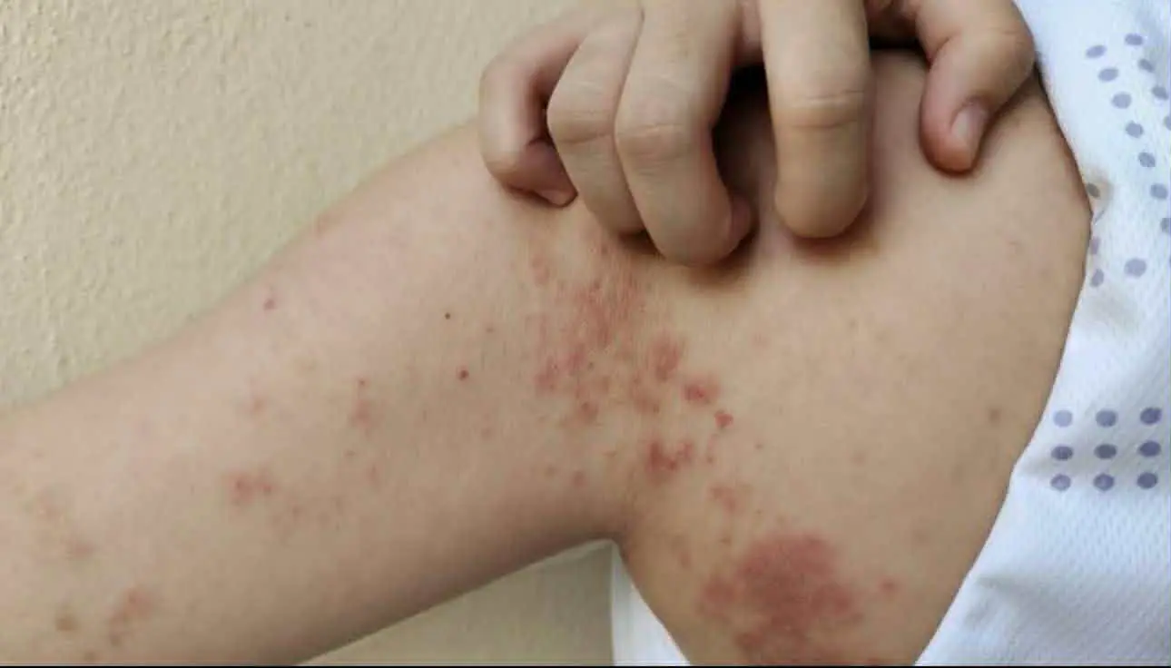 7 Warning Signs Your Body May Have Parasites