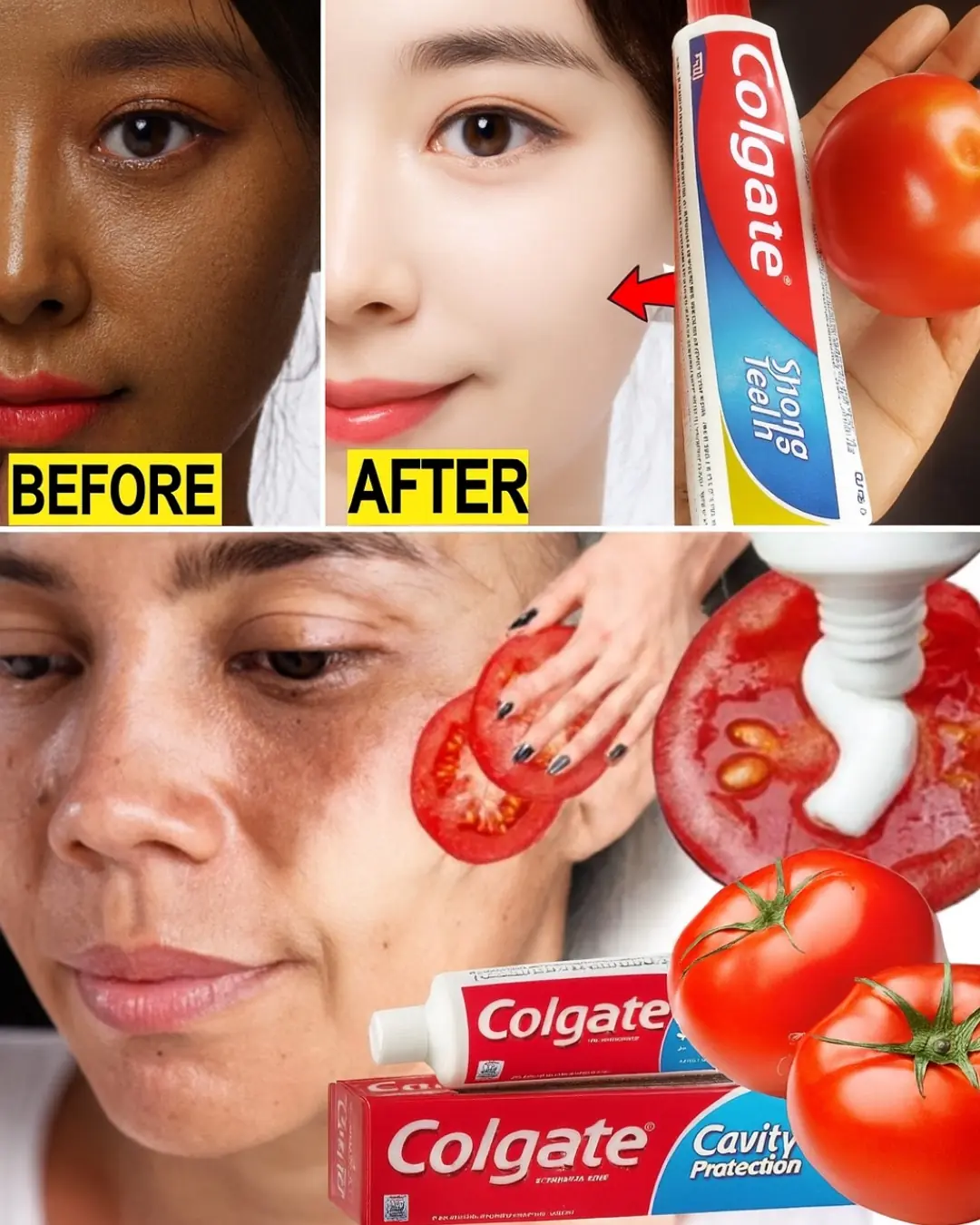 Tomato and Colgate Toothpaste Face Mask: Glow-Up Hack or Skin Care Risk?