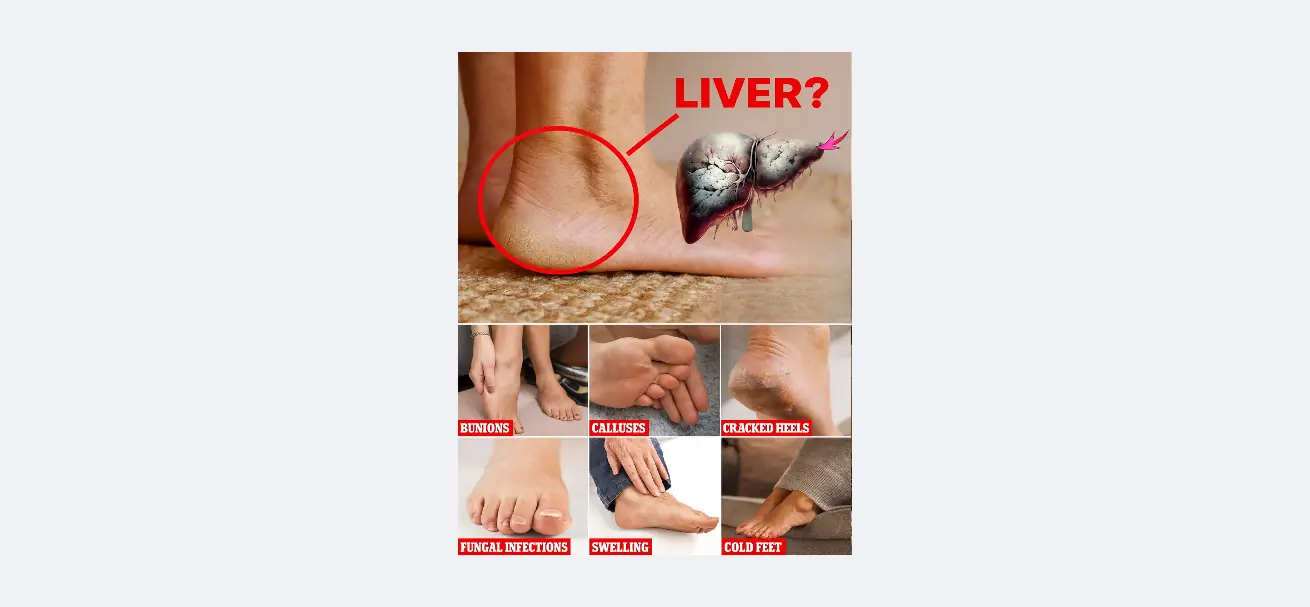 Your Feet Are Screaming for Attention: 6 Shocking Health Clues Hidden in Your Soles!