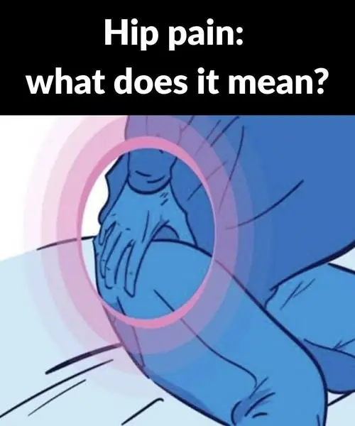 🦵 Hip Pain: What Does It Mean? Common Causes & When to Seek Help