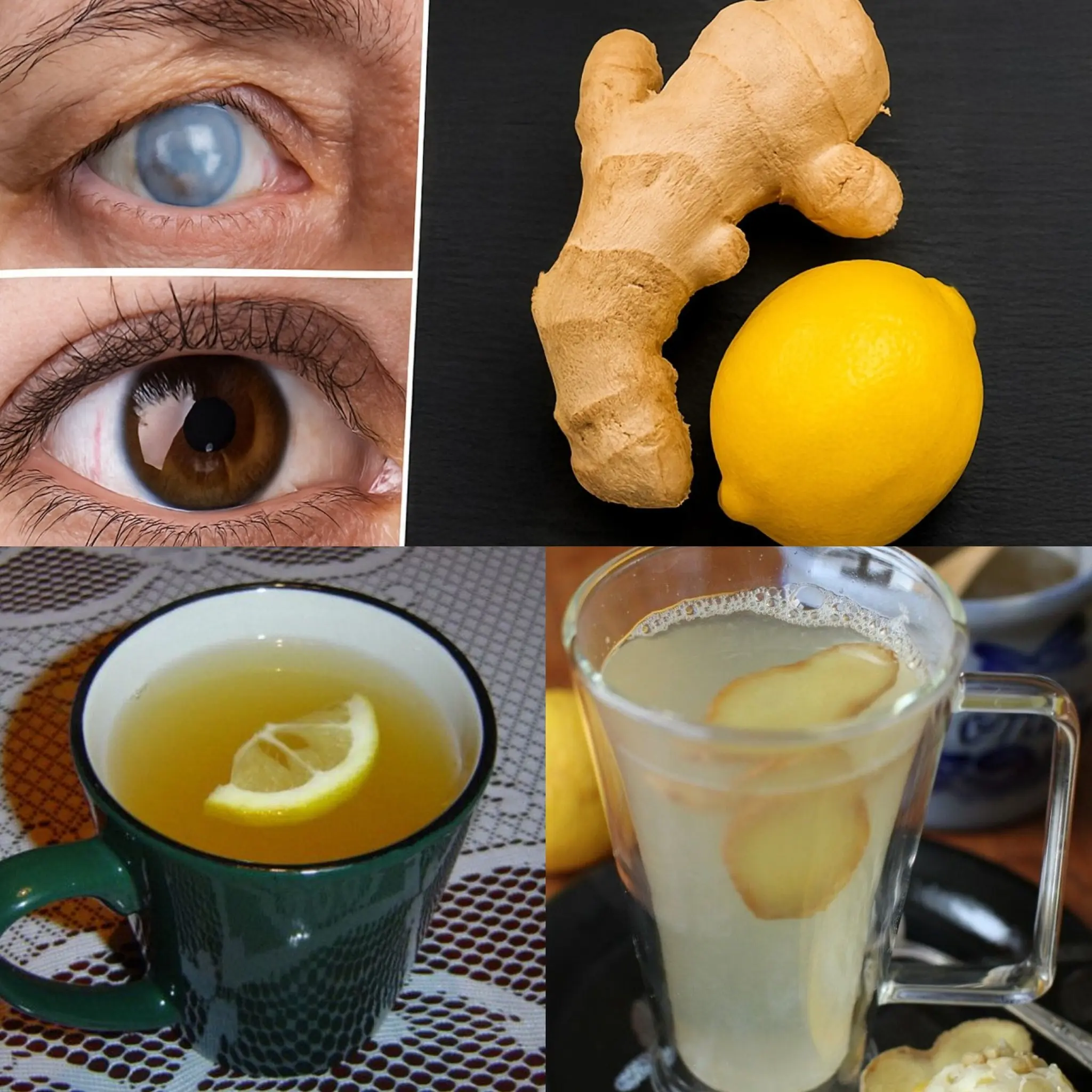 Restore Your Vision Naturally: A Simple Ginger and Lemon Recipe
