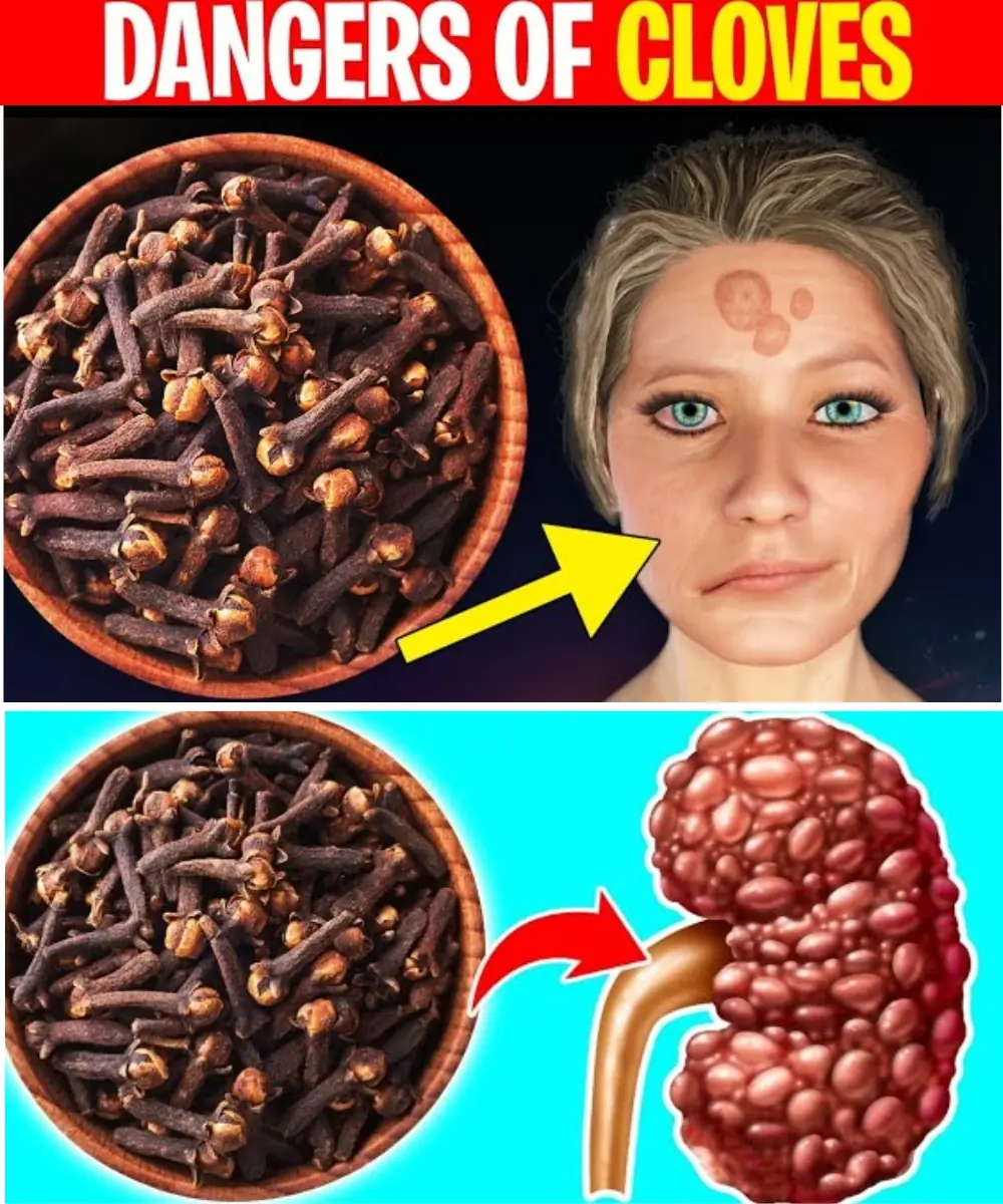 ❗Avoid Cloves If You Have These Health Issues – What Doctors Rarely Warn You About