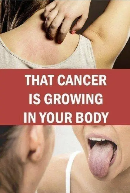🚩 19 Possible Signs of Cancer: When to See a Doctor