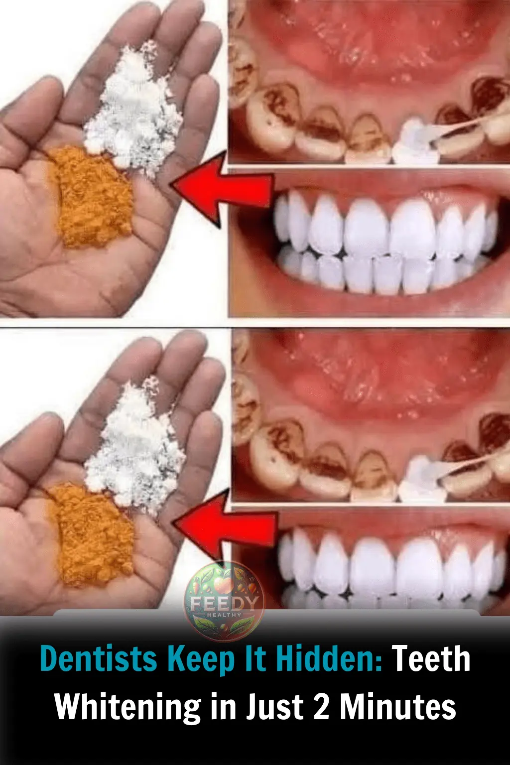 Homemade Teeth Whitening: White Teeth in Just 2 Minutes!