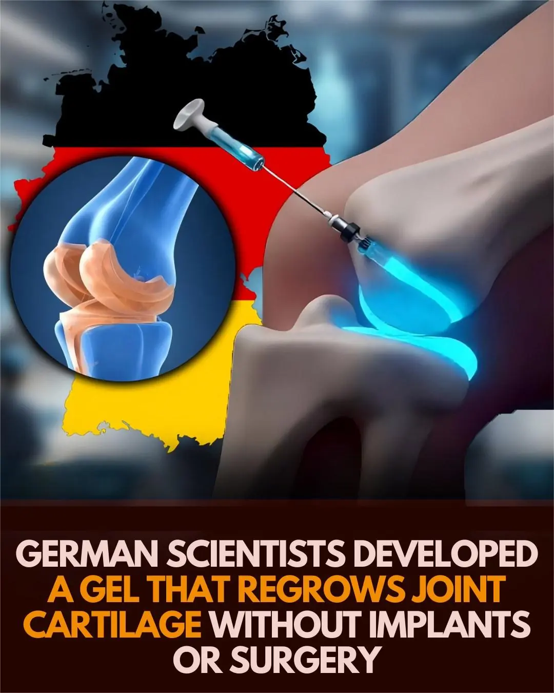 Germany’s Cartilage Repair Gel: Hope, Hype, and the Future of Joint Regeneration