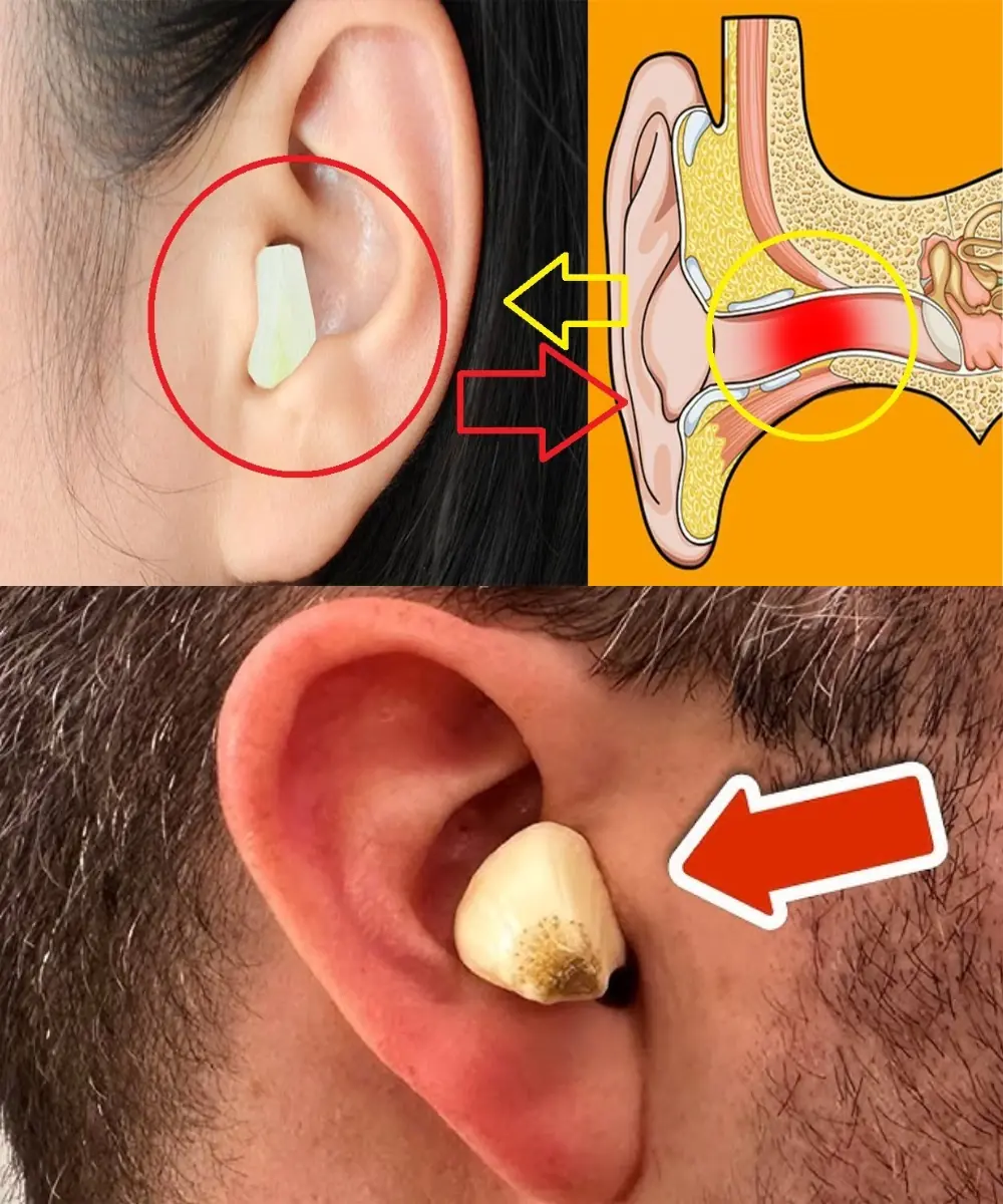 Garlic and Onion: The Natural Secret to Better Hearing