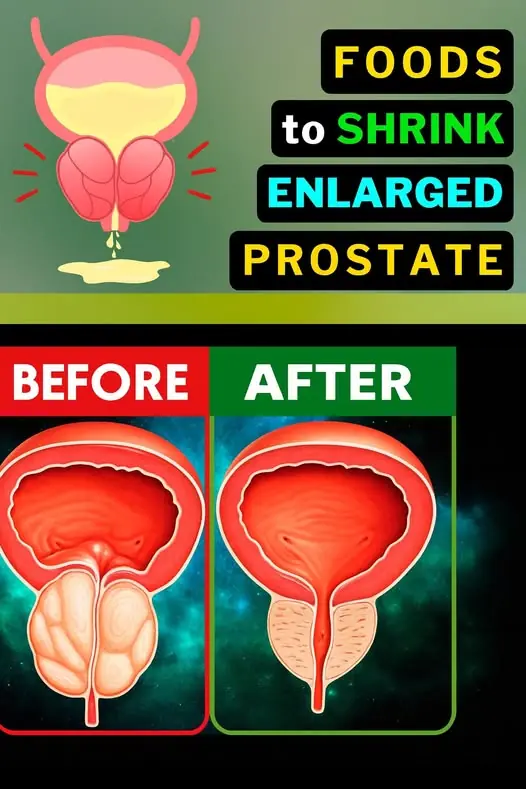 8 Common Foods That May Harm Prostate Health – And What to Choose Instead
