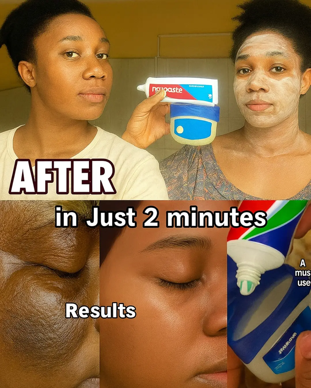 Discover the Toothpaste and Vaseline Hack for Radiant Skin Youโll Wish You Knew Sooner
