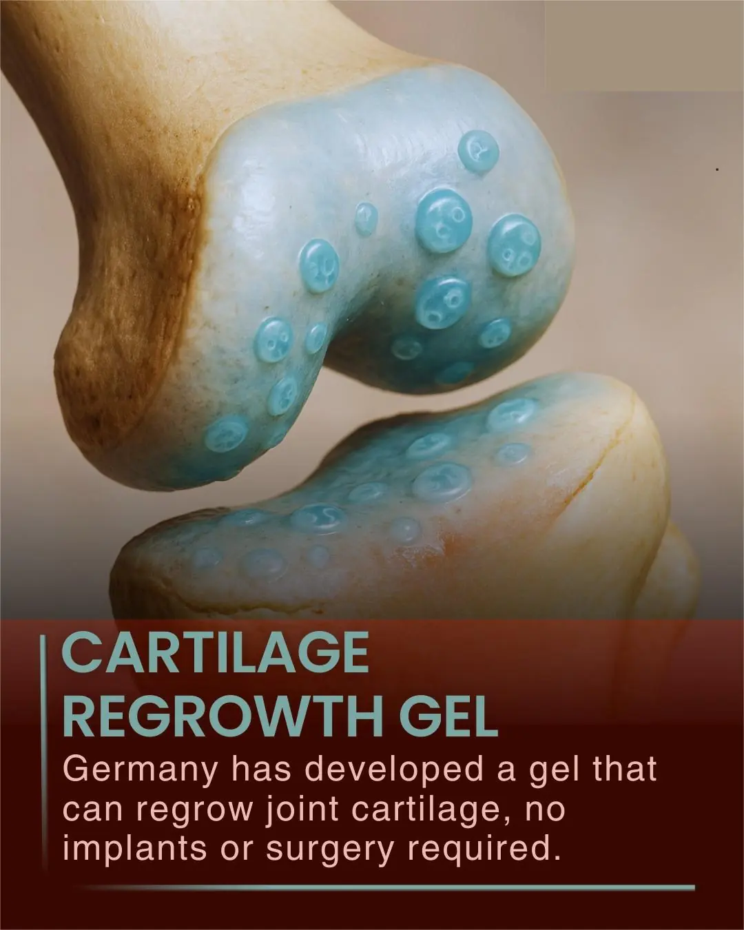 German Scientists Develop Regenerative Gel That Could Transform Joint Treatment