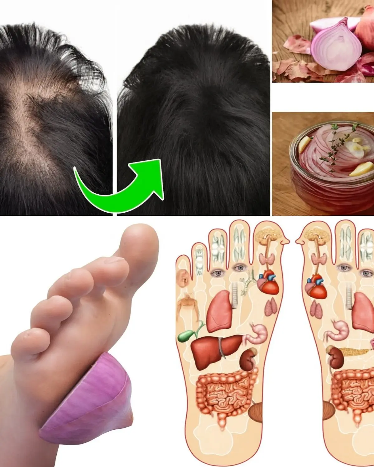 14 Ingenious Ways Onions Can Improve Your Health at Home