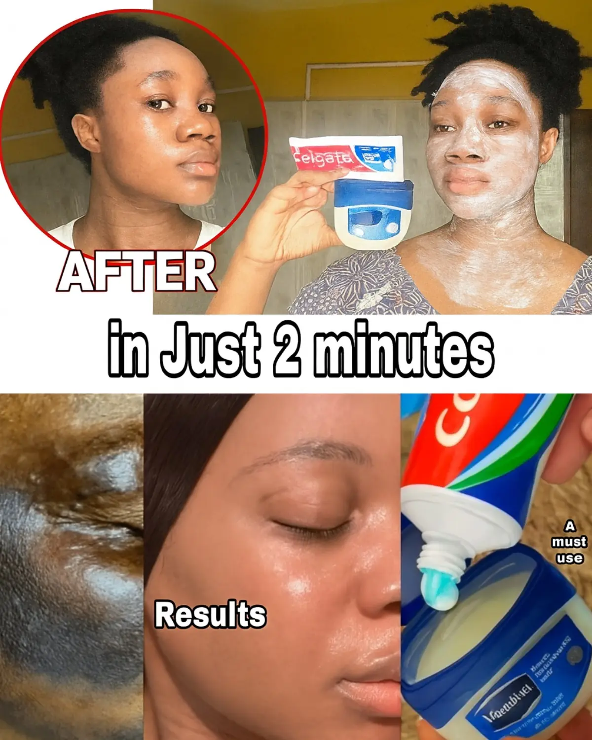 I Applied Toothpaste and Vaseline on My Face – Here’s What Happened