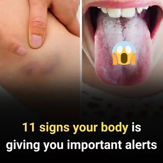 11 Signs Your Body Is Giving You Important Alerts